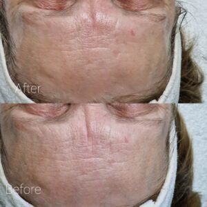 KRX Gezichtsbehandelingen