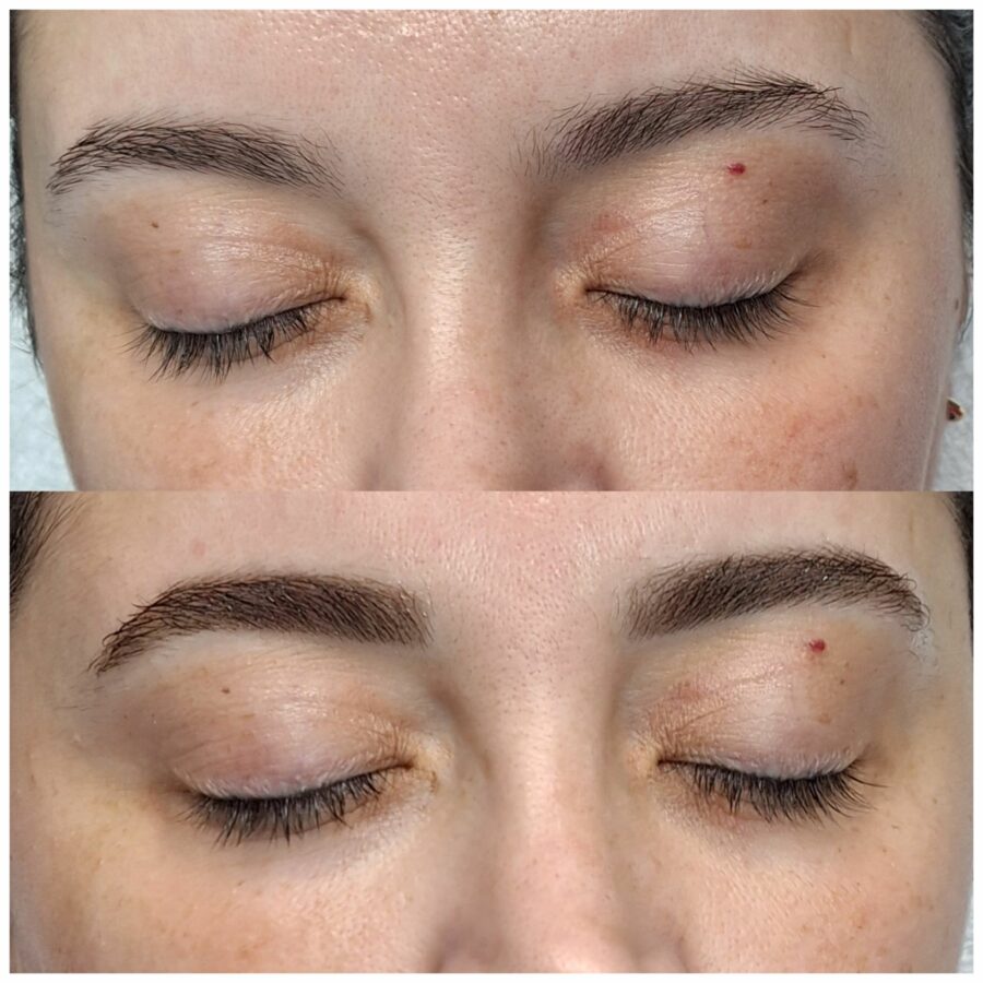 Phi Hennabrows behandeling